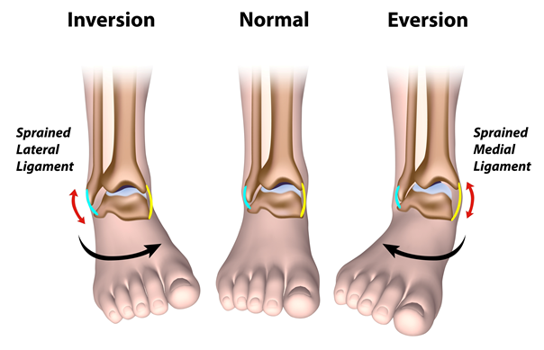 dislocation